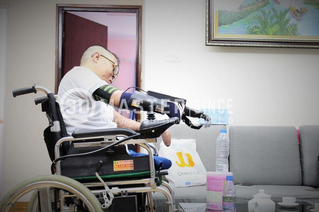 Chiến sĩ phi công gặp nạn và đôi tay robot có thể cầm nắm được chế tạo bởi 3D Master