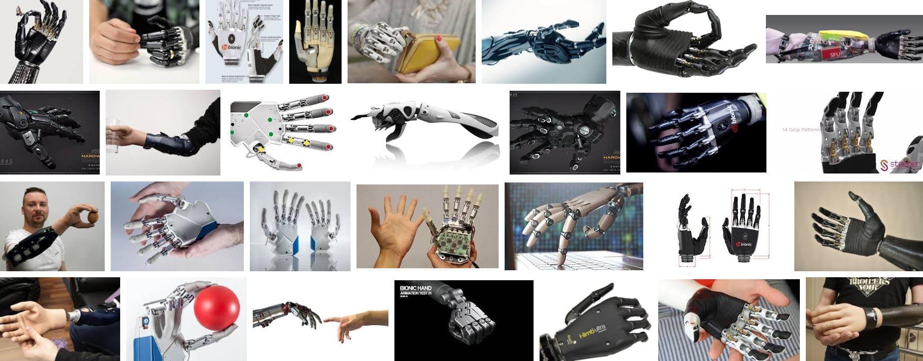 The prosthesis is controlled by the nerve