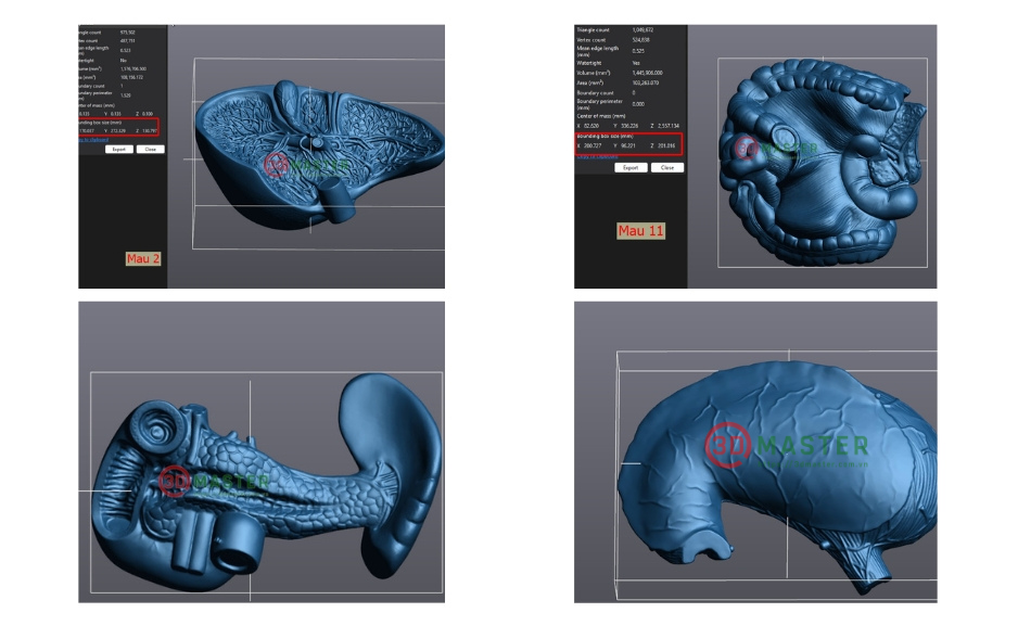 Kết quả scan 3D học cụ y tế