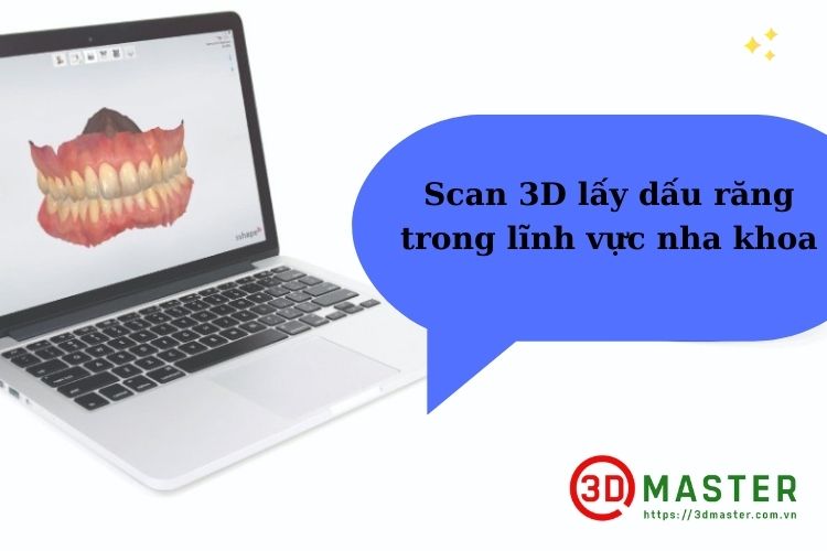 3D scanning takes tooth impressions in the dental field